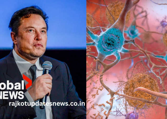 rajkotupdates.news Elon Musk in 2022 Neuralink Start to Implantation of Brain Chips in Humans